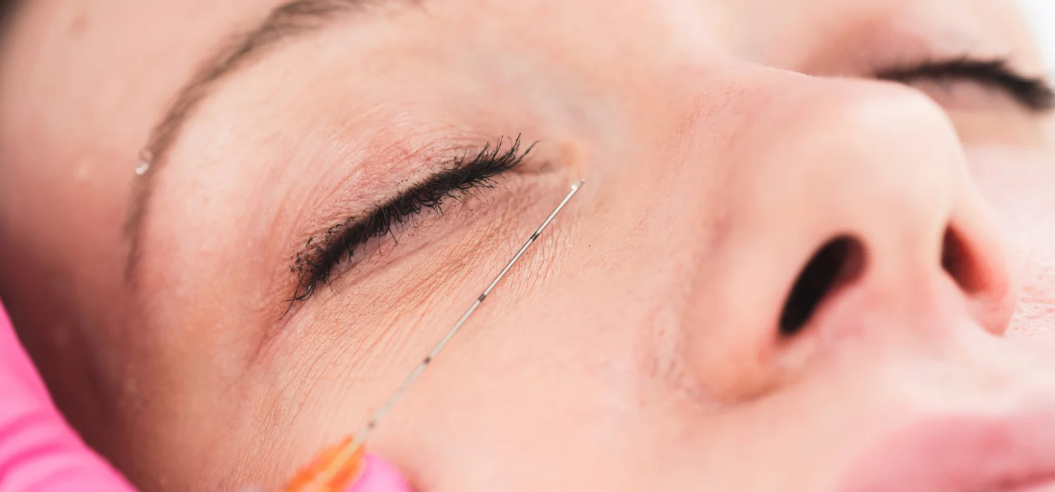 Restylane Lyft Newport Beach